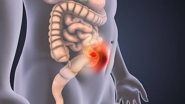 Inguinal hernia consultation